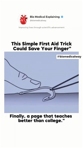 Bio Medical Explanaing on Instagram: "Getting a fishhook stuck in your skin can be painful and scary, but some minor fishhook injuries can be managed safely with proper first aid. One common method is the string-yank technique, often used in outdoor or emergency settings. This method works best when the hook is superficial, the barb is not deeply embedded, and the injury is not near sensitive areas. Basic idea of the method: A loop of strong string is wrapped around the curve of the hook. While 