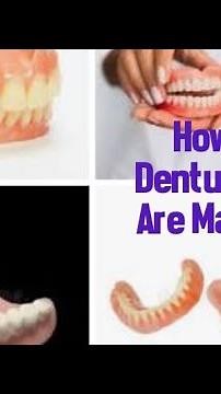 How Dentures are made Step by Step