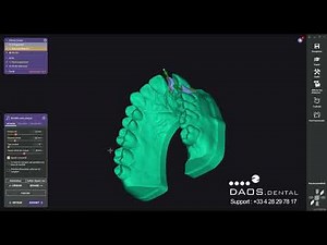 Exocad Rijeka 3.1 - Model Creator Sans Dies Amovibles - Daos Dental