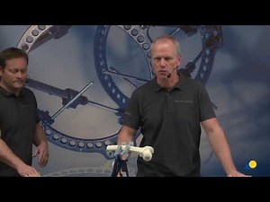 AO Expert meeting latest advances in minimally invasive neck femur fixation femur neck system