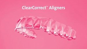ClearCorrect™ aligners are now even more customizable with premade cutouts to help you achieve optimal results. Elastics used with cutouts in clear aligners is an effective technique used to correct different types of malocclusions during clear aligner treatment. Class II and Class III malocclusions, open bites and crossbites can all be corrected with the use of elastics and cutouts, providing the patient is fully compliant in wearing the elastics as directed by the treating clinician. #clearcor
