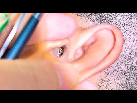 Relaxing Ear Cleaning | Oddly Satisfying Close-Up