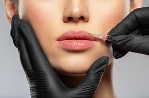 Botox: Συναγερμός στη Βρετανία από την... κατάρα των παράνομων ενέσεων - Δεκάδες θύματα - ΤΑ ΝΕΑ
