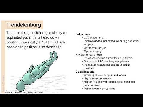 Transferring a patient and positioning for surgery | Anaesthesia