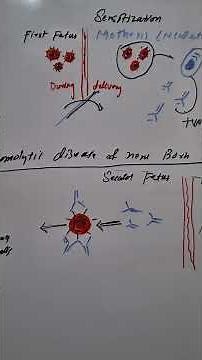 hemolytic disease of newborn (HDN)