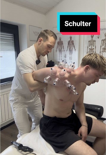 Behandlung der Schulter mit Kuppel- und Gua Sha-Techniken