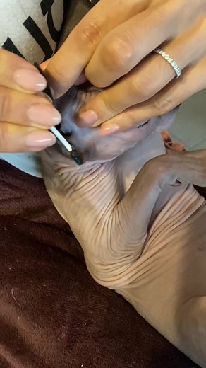 👂 #pimples #pimple #pimplepop #pimplepopper #sphynxpimples #foryou #fyp #cleaner