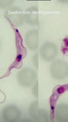 Question time - Identify parasites #parasitologia #parasite #microbiology #microbiologist #microbiologylab #explorepage #bacteriology #microbe #science #kesfet #molecularbiology #virology #microbiologia #mikrobiyoloji #bacteria #bakteri #parasite #parasitologia #parazit #parasitology #stool #sample #microscopy #lab #phd #laboratory | Medical Microbiologist