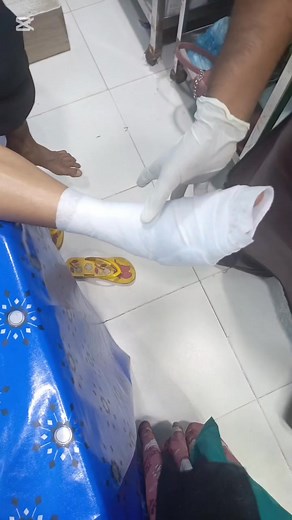 14 reactions | Acute ankle injury case. Pain control ও proper stabilization-এর জন্য ankle joint–এ backslab apply করা হলো। এই backslab টি swelling কমাতে, joint movement নিয়ন্ত্রণ করতে ও দ্রুত healing শুরু করতে সাহায্য করে।” | Healthix | Facebook