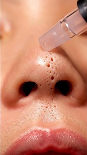 “Every Pore Cleaned Perfectly! Realistic Deep Facial ASMR”