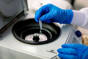 Fibromyalgia – New discoveries and latest research - Mayo Clinic Press