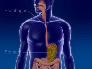 Understanding Gastroesophageal Reflux Disease (GERD)