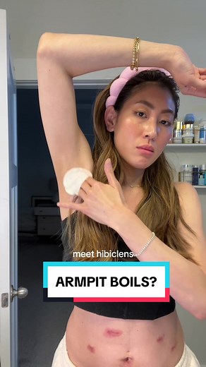 Creative Uses of Hibiclens for Skincare - Expert Tips