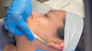 ✨ DERMAPLANE GLOW IS HERE! ✨ Smooth. Bright. Flawless. ...