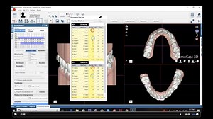 Webinar NemoCast. Diagnostic Occlusal Measurement in Orthodontics