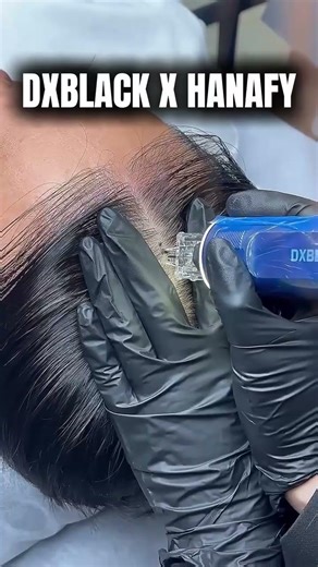 Τριχοπυρόχρωση(SMP) Tutorial 🥰 |Επαγγελματική Τριχοπιγμεντοποίηση από PMU Artist @d_chris_black