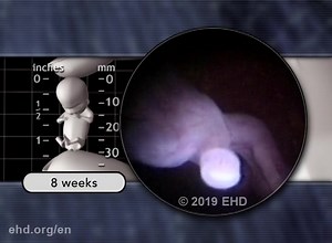 Welcome to...'Your Life Before Birth' 🫶🏻 ehd.org | Precious Life