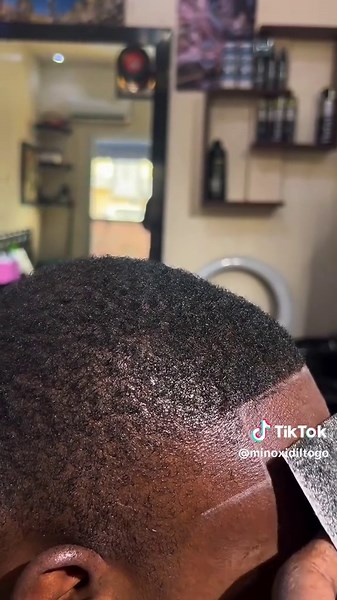 Solution miracle contre la calvitie avec la fibre capillaire