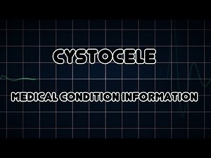Cystocele (Medical Condition)
