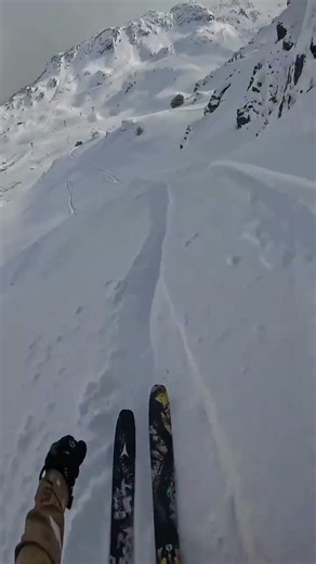 He Lost a Lens… and Still Podiumed 🤯 6. This Is Why the Realm Goggle Exists