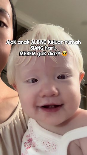 Bayi Albino Ashley di Luar Rumah Saat Terang