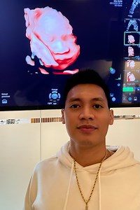 701K views · 10K reactions | Congenital Anomaly Scan ni Little Scottie guys. Sa ultrasound palang mukhang alam na sino kamukha Thank you Lord healthy and normal si baby | Scottie Thompson | Facebook