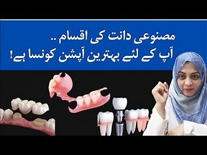 Denture, Bridge or Implant? Which one is best Artificial teeth