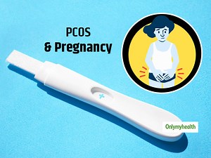 What is PCOS? Know How It Hampers Pregnancy In Women, Risk Factors & Tips To Manage PCOS