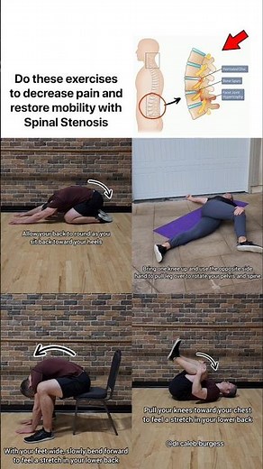 Low Back Pain Relief - Spinal Stenosis Exercises