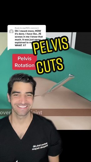 Pelvis Rotation and Bone Relocation Techniques