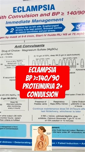 Eclampsia management #eclampsia #pregnantwoman #convulsion #medicalemergency #medicalinformation