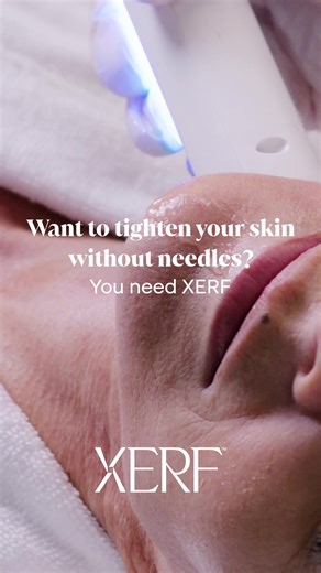 XERF Skin Tightening: A Revolutionary Non-Surgical Solution
