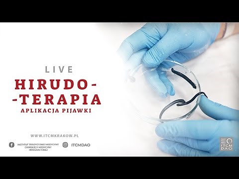#18 Hirudoterapia - Aplikacja Pijawki. Jak postawić pijawkę? | Live z kursu