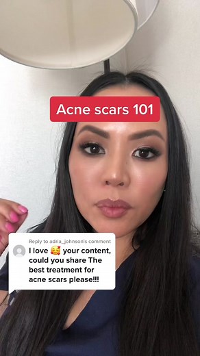 Effective Treatment Approaches for Acne Scars