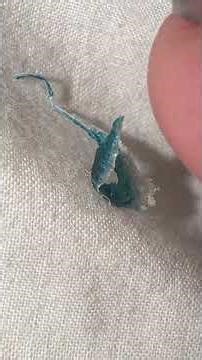 Extraction from top of shoulder