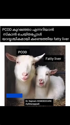 doctor.pcod | "PCOD ഉള്ള മിക്കവർക്കും fatty liver കണ്ടുവരാൻ കാരണങ്ങളുണ്ട്. ഒന്നാമത്, insulin resistance – രക്തത്തിലെ പഞ്ചസാര ശരിയായി ഉപയോഗിക്കപ്പെടാതെ,... | Instagram
