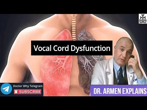Vocal Cord Dysfunction (VCD). What is Paradoxical Vocal Cord Motion?