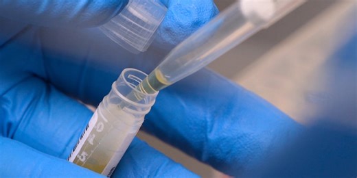 NIH funding cuts have affected over 74,000 people enrolled in experiments, a new report says