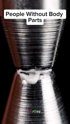 Exploring Human Evolution: Uncommon Body Variations