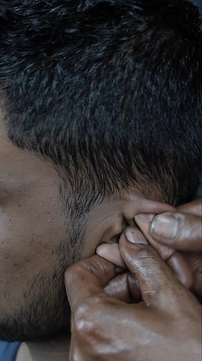 20K views · 269 reactions | Very Crunchy Neck Crack With Head massage ASMR #reels #asmr #massage #unclebarber | Home ASMR clinic | Facebook