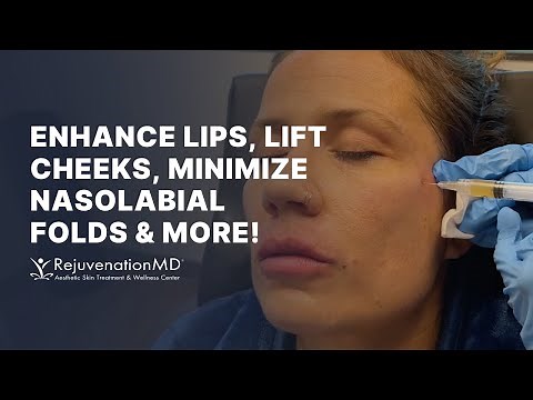 PRP Facelift: A Safe and Natural Path to Rejuvenation