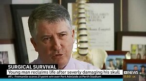 Fifteen-year-old Connor Meldrum will undergo surgery with Neurosurgeon Dr Rob Campbell at Mater Private Hospital Brisbane to repair his skull using a custom 3D printed piece. Connor has an incredible story to share! | Mater