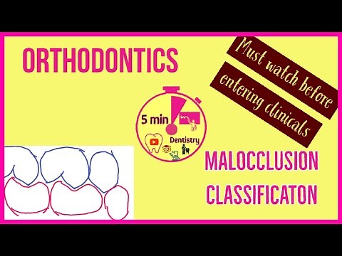 MALOCCLUSION | ANGLE'S CLASSIFICATION | ORTHODONTICS | 5 min DENTISTRY