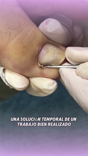 Would you like to learn aesthetic pedicure, foot spa, and ingrown toenail techniques? 👣✨