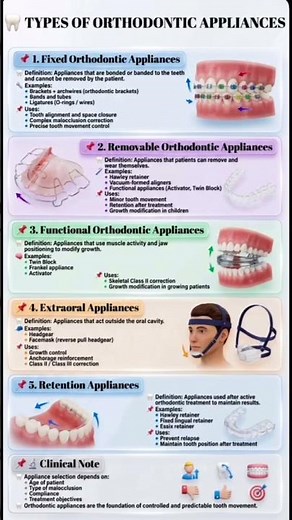 Types of Orthodontic Appliances #orthodontics #orthogo
