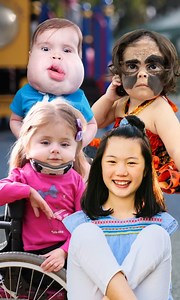 9 kids who were born to inspire ❤️ #reels #viral #borndifferent #truly #borntosinpire #incrediblekids #kids #inspiringkids #disabilities #defyingodds #family #love #inspire #positive #bonesofglass #limbdifferences #physicaldifferences #medicine | Born Different