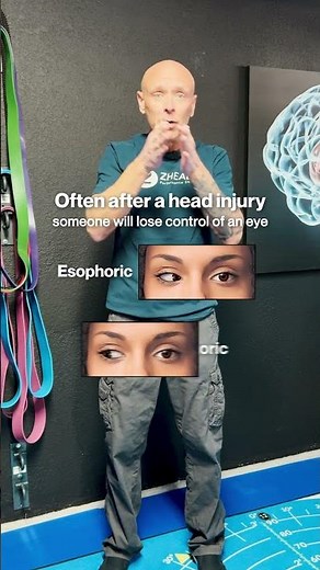 A Simple Eye Test Can Reveal Hidden Concussion Issues