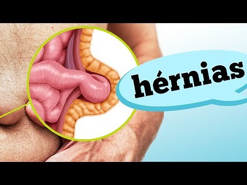 TIPOS DE HÉRNIA: O QUE É E COMO RECONHECER?