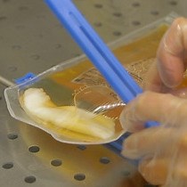 Video: Mesenchymal Stromal Cell Culture and Delivery in Autologous Conditions: A Smart Approach for Orthopedic Applications