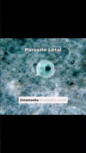 Entamoeba histolytica causes amebiasis #water #science #health